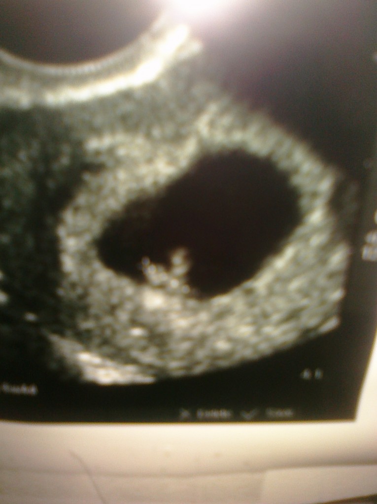 6 weeks