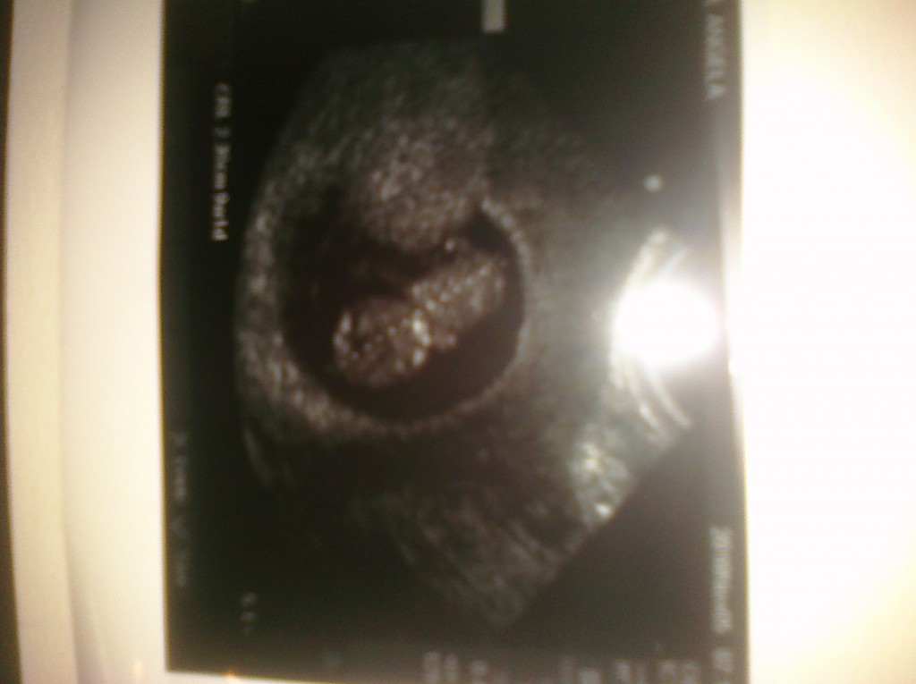 9 weeks